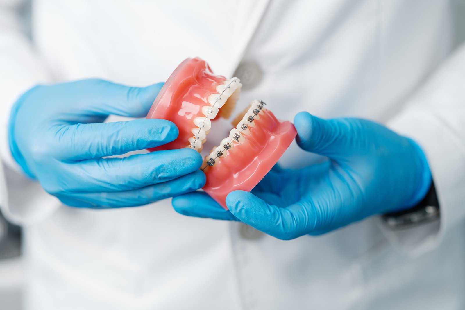 Functional Orthodontics