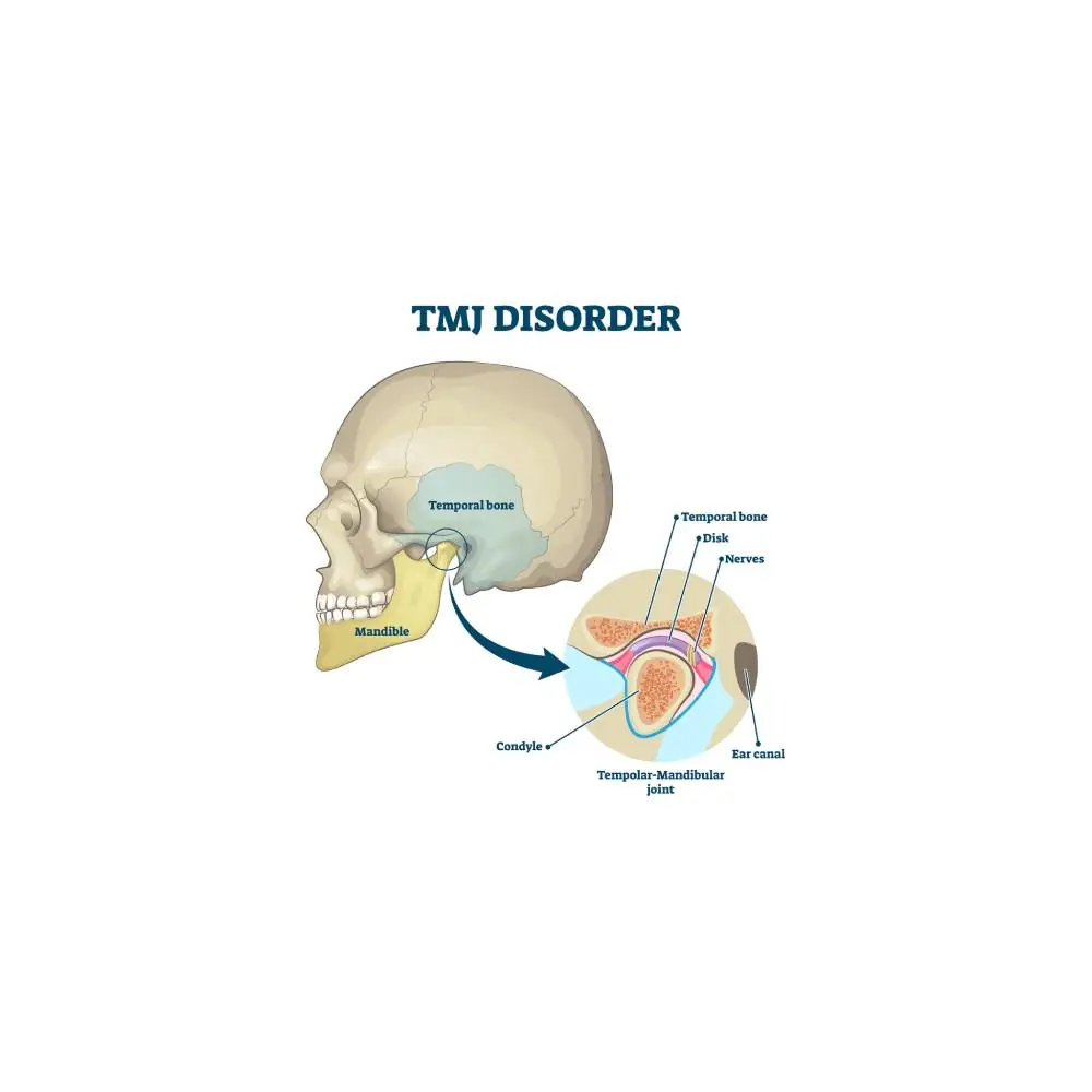 TMJ Disorder